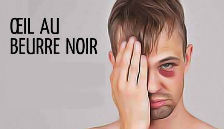 Un oeil au beurre noir et une visière régulière pour Max Pacioretty | Marinaro a une stratégie intimidante pour le CH