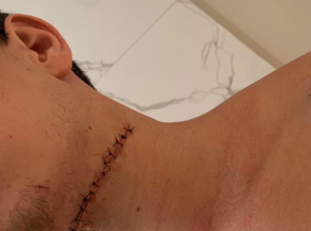 Un ancien joueur de la LHJMQ a reçu un coup de couteau (au cou)