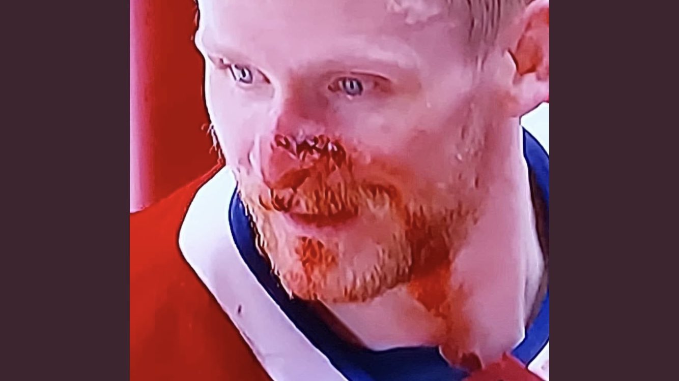 Les arbitres ont été tout simplement affreux lors du troisième match