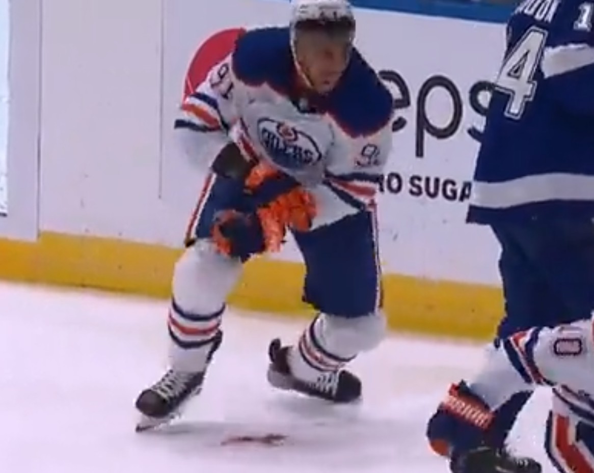 Top-5 : Evander Kane coupé à l'avant-bras