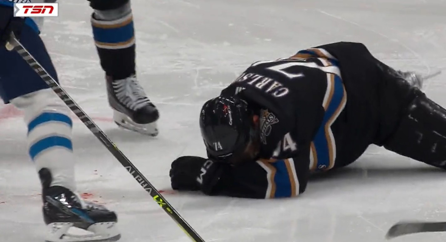 John Carlson a dû se faire rattacher l'oreille à la tête après avoir reçu un tir