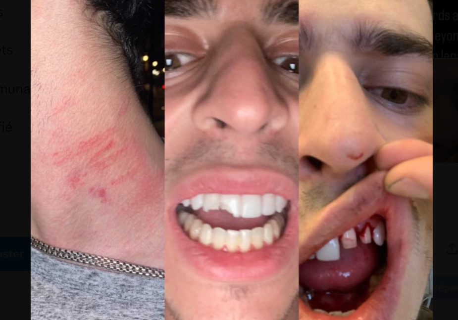 Un ancien pilote d'IndyCar affirme que Daniel Sprong l'a attaqué