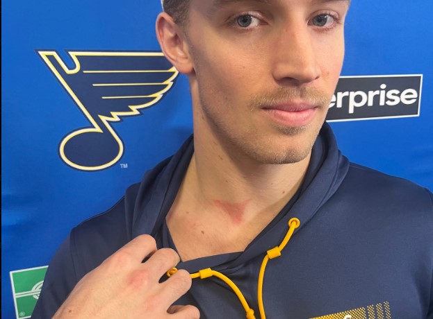 Rondelle au cou : Dylan Holloway « ne pouvait pas laisser passer un 2 contre 1 »